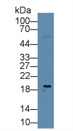 Polyclonal Antibody to Dyskerin (DKC)