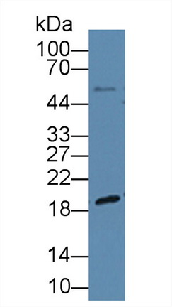 Polyclonal Antibody to Dyskerin (DKC)