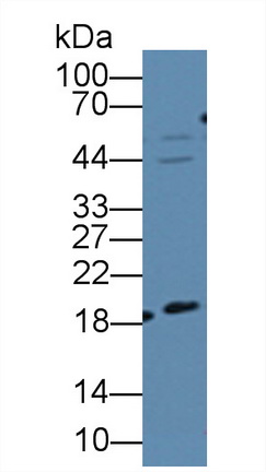 Polyclonal Antibody to Dyskerin (DKC)