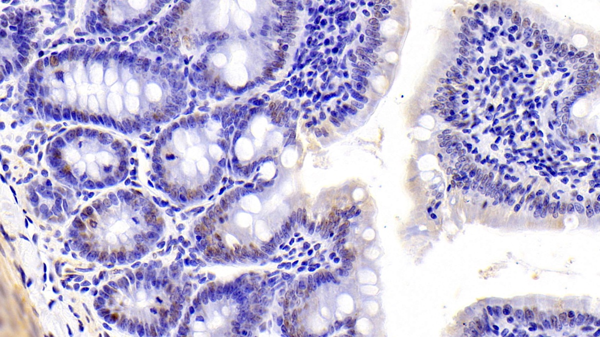 Polyclonal Antibody to Dyskerin (DKC)