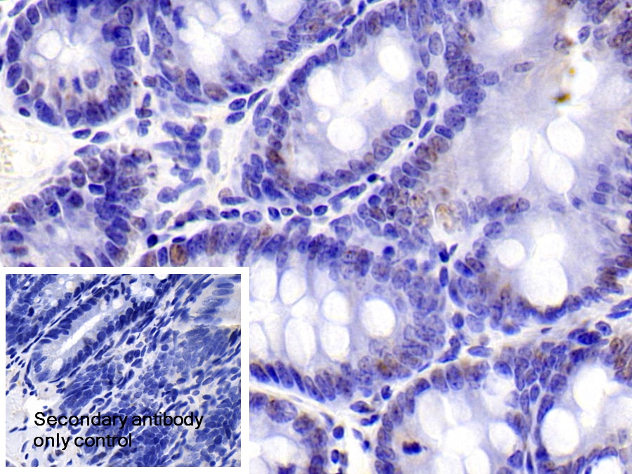 Polyclonal Antibody to Dyskerin (DKC)