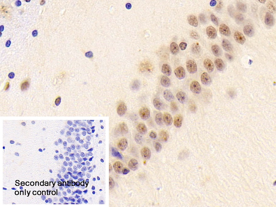 Polyclonal Antibody to Dyskerin (DKC)