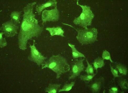 Polyclonal Antibody to Epithelial Cell Transforming Sequence 2 (ECT2)