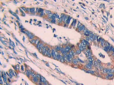 Polyclonal Antibody to Epithelial Cell Transforming Sequence 2 (ECT2)