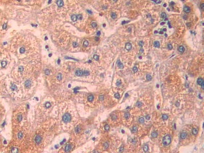 Polyclonal Antibody to Epithelial Cell Transforming Sequence 2 (ECT2)