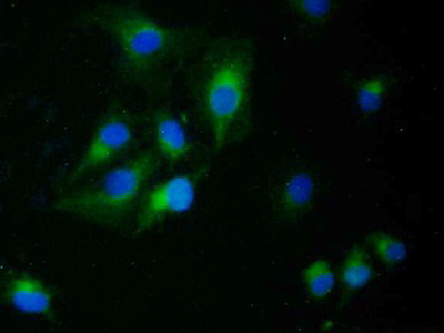 Polyclonal Antibody to Epithelial Cell Transforming Sequence 2 (ECT2)