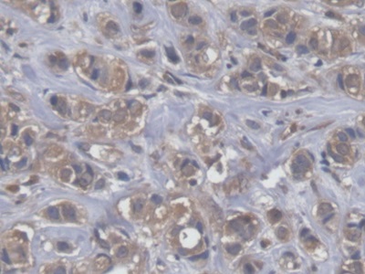 Polyclonal Antibody to Eukaryotic Translation Elongation Factor 2 (EEF2)