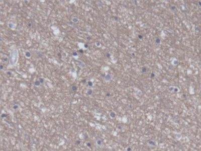 Polyclonal Antibody to Eukaryotic Translation Elongation Factor 2 (EEF2)