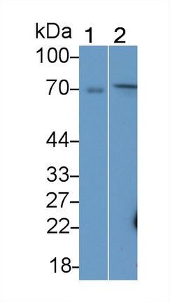 Polyclonal Antibody to Cytosolic Ovarian Carcinoma Antigen 1 (COVA1)