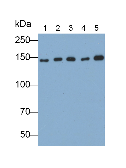 Polyclonal Antibody to Endoplasmic Reticulum To Nucleus Signalling 1 (ERN1)