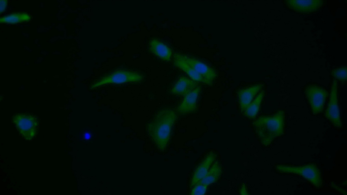 Polyclonal Antibody to Endoplasmic Reticulum Protein 29 (ERP29)