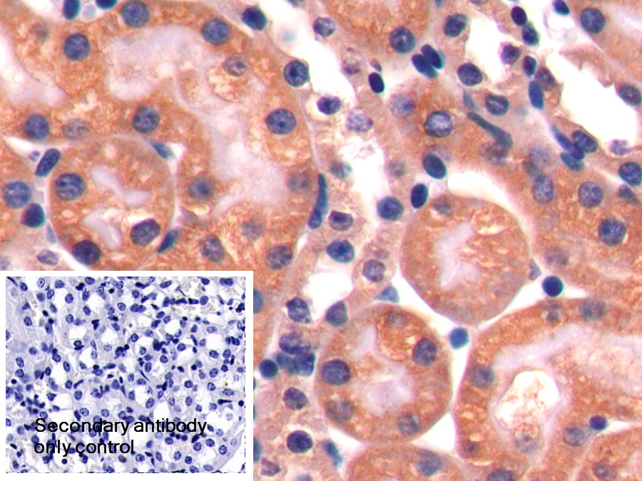 Polyclonal Antibody to Endoplasmic Reticulum Protein 29 (ERP29)