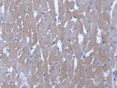 Polyclonal Antibody to Endothelin 3 (EDN3)