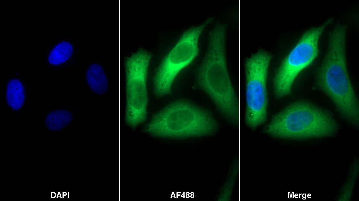 Polyclonal Antibody to Fatty Acid Synthase (FASN)