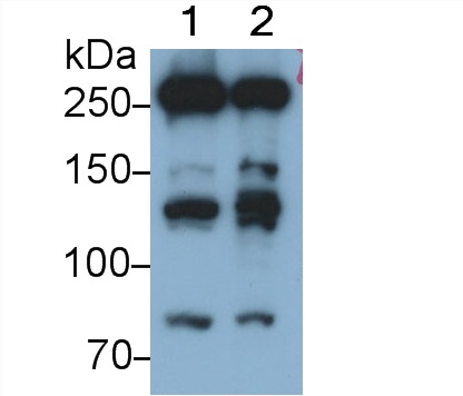 Polyclonal Antibody to Fatty Acid Synthase (FASN)