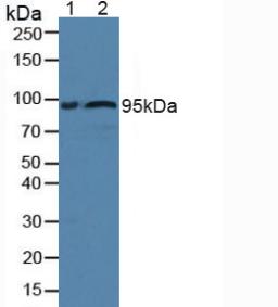 Polyclonal Antibody to Fibulin 1 (FBLN1)