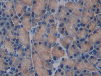 Polyclonal Antibody to Fibulin 1 (FBLN1)