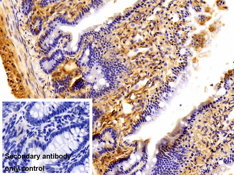 Polyclonal Antibody to Fibulin 1 (FBLN1)