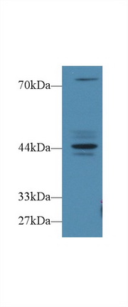 Polyclonal Antibody to Fibrosin (FBS)