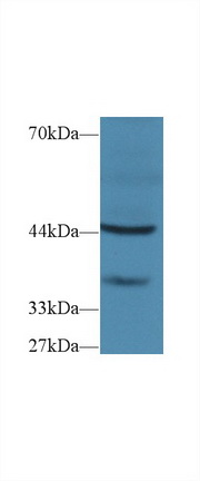 Polyclonal Antibody to Fibrosin (FBS)