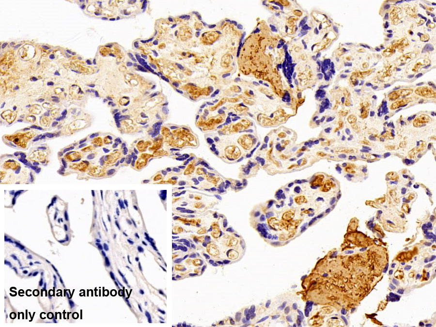 Polyclonal Antibody to Fibrinogen Gamma (FGg)