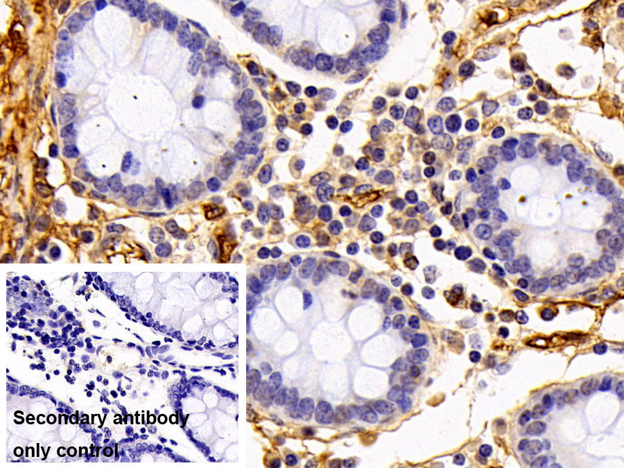 Polyclonal Antibody to Fibrinogen Gamma (FGg)