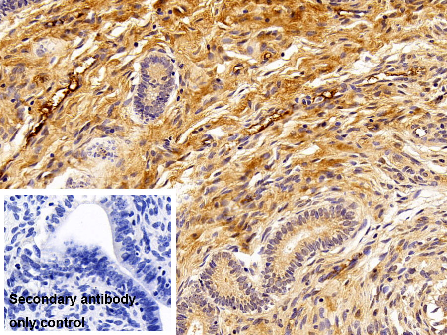 Polyclonal Antibody to Fibrinogen Gamma (FGg)