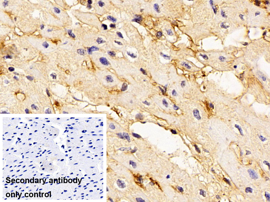 Polyclonal Antibody to Fibrinogen Gamma (FGg)