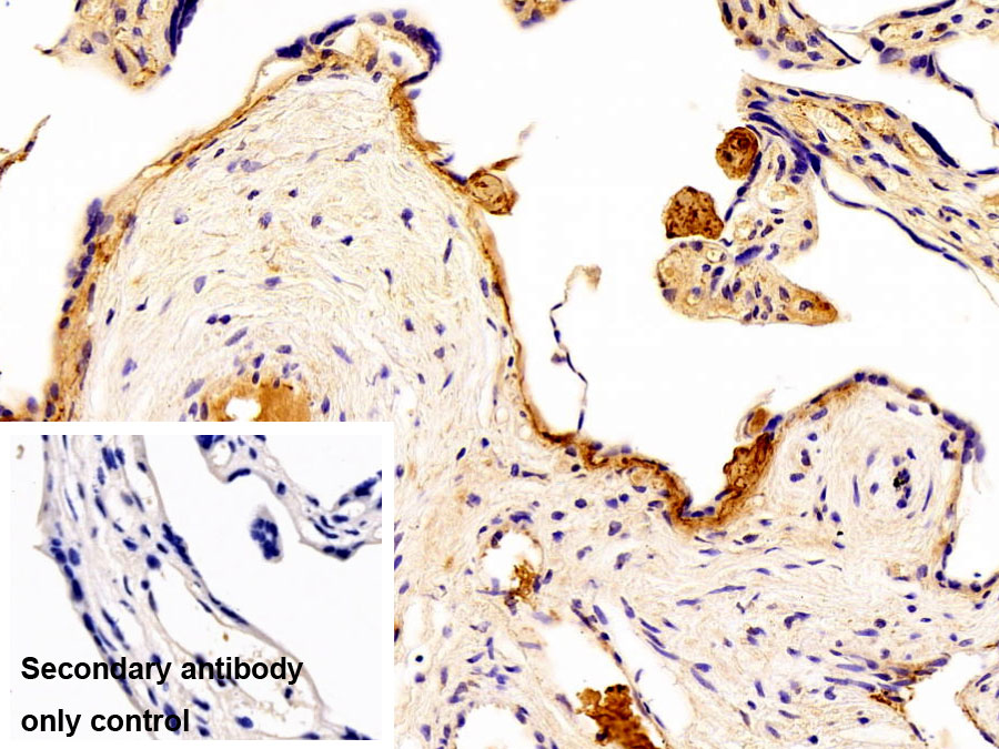 Polyclonal Antibody to Fibrinogen Gamma (FGg)