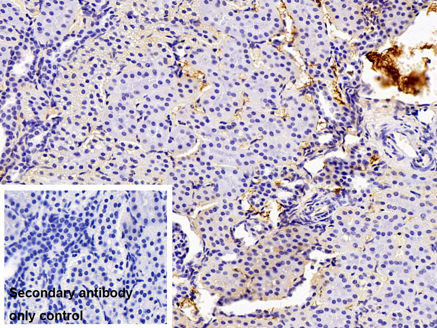 Polyclonal Antibody to Fibrinogen Gamma (FGg)