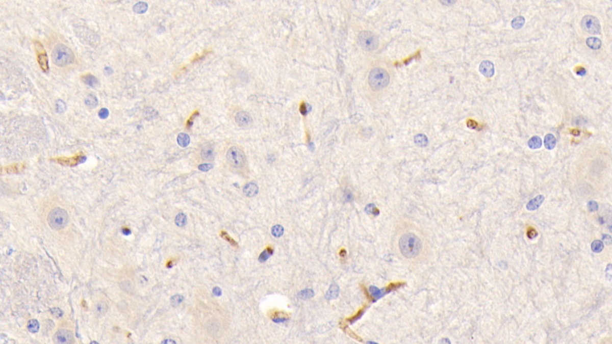 Polyclonal Antibody to Fibrinogen Gamma (FGg)