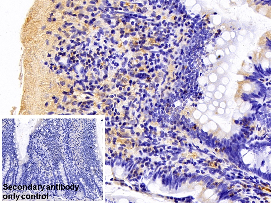 Polyclonal Antibody to Fibrinogen Gamma (FGg)