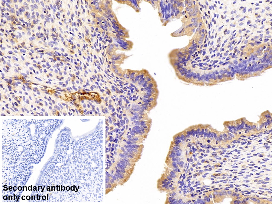 Polyclonal Antibody to Fibrinogen Gamma (FGg)