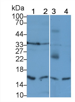 Polyclonal Antibody to FK506 Binding Protein 2 (FKBP2)