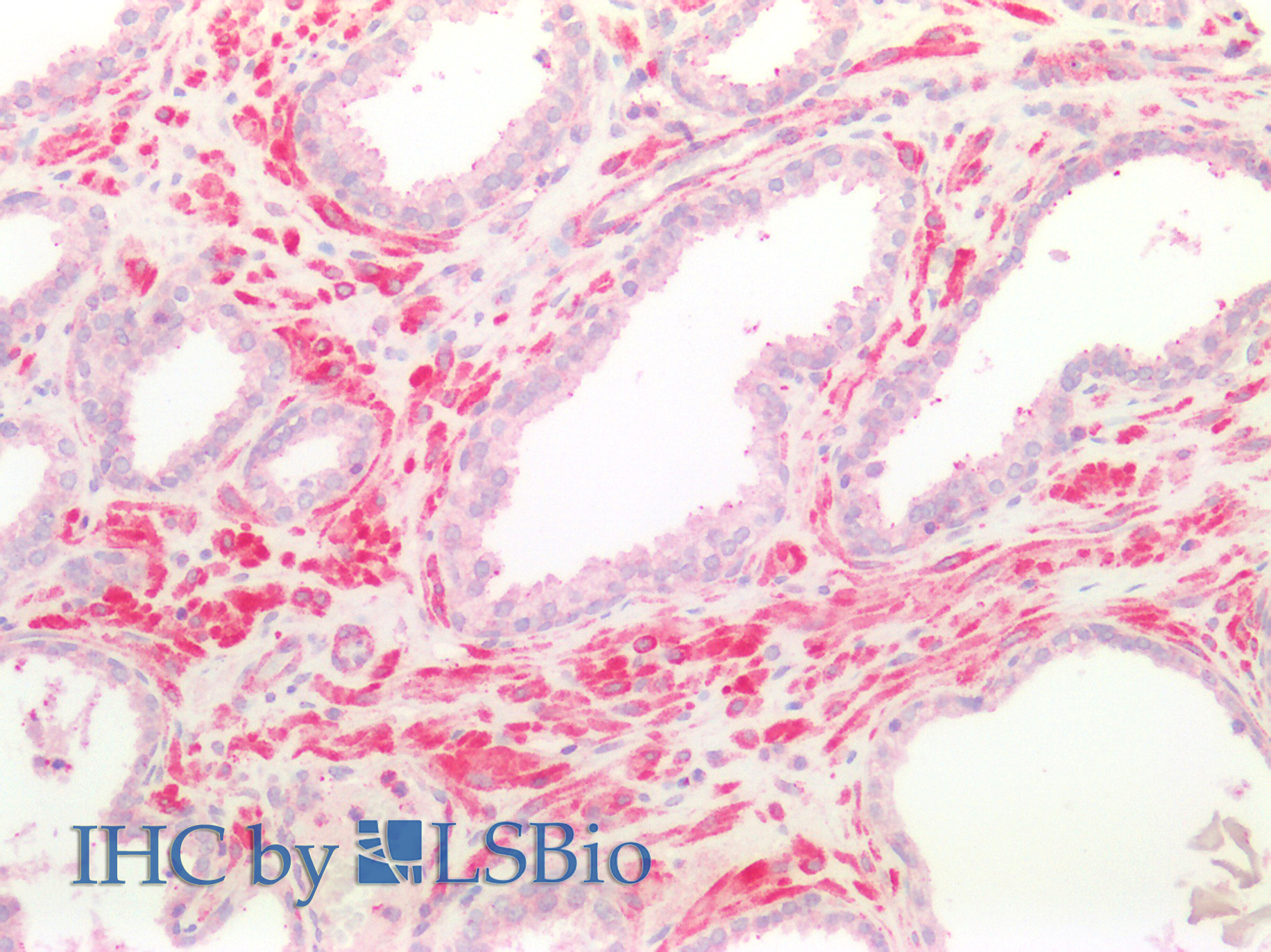 Polyclonal Antibody to Folylpolyglutamate Synthase, Mitochondrial (FPGS)