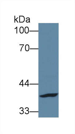 Polyclonal Antibody to Fucose-1-Phosphate Guanylyltransferase (FPGT)