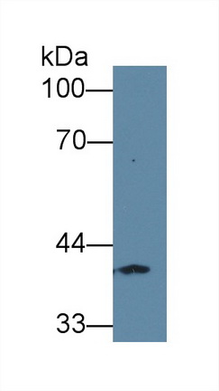 Polyclonal Antibody to Fucose-1-Phosphate Guanylyltransferase (FPGT)