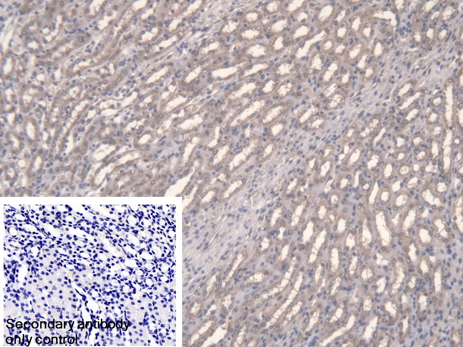 Polyclonal Antibody to Fucose-1-Phosphate Guanylyltransferase (FPGT)