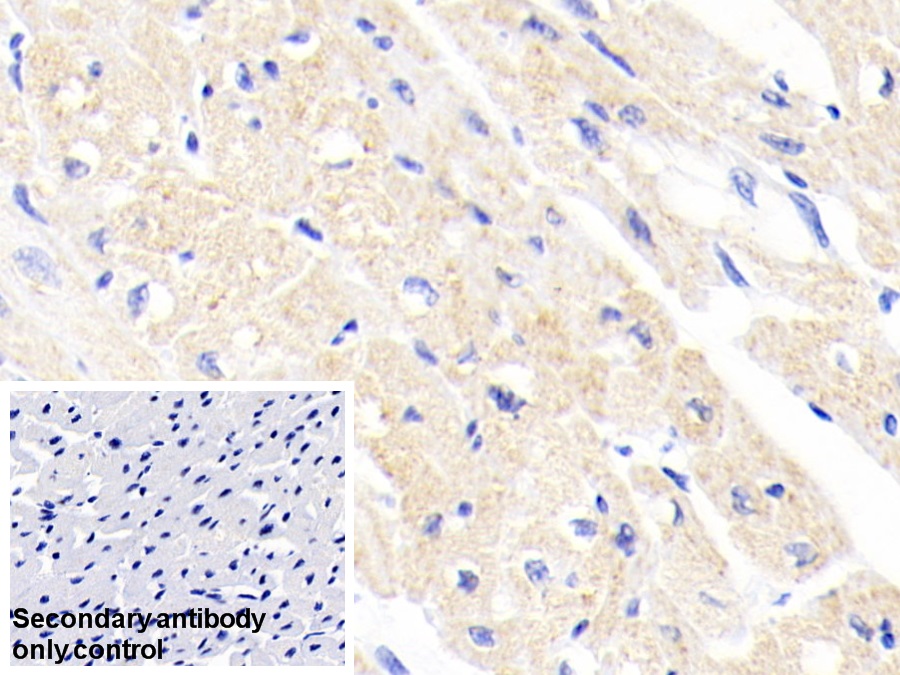 Polyclonal Antibody to Ferrochelatase (FECH)