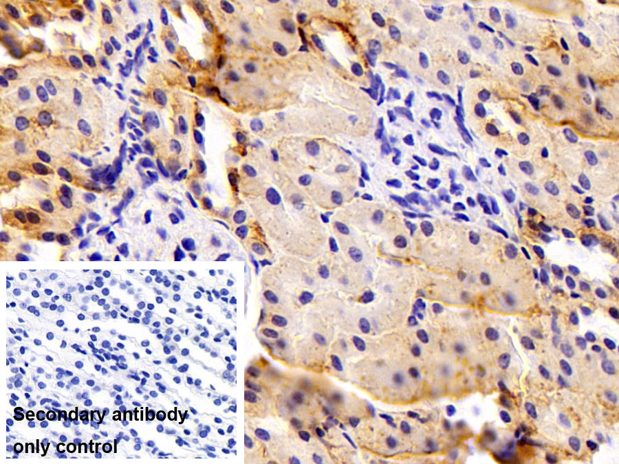 Polyclonal Antibody to Ferroportin (FPN)