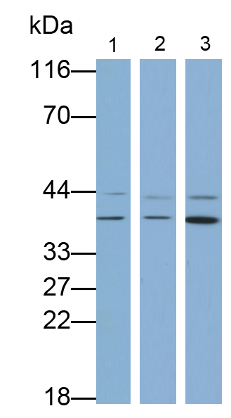 Polyclonal Antibody to Fibrillarin (FBL)