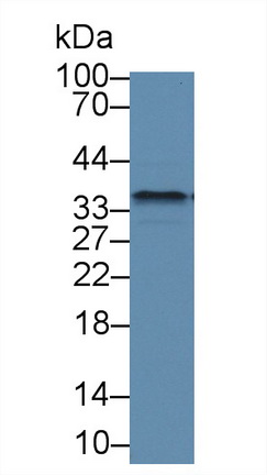 Polyclonal Antibody to Fibrillarin (FBL)