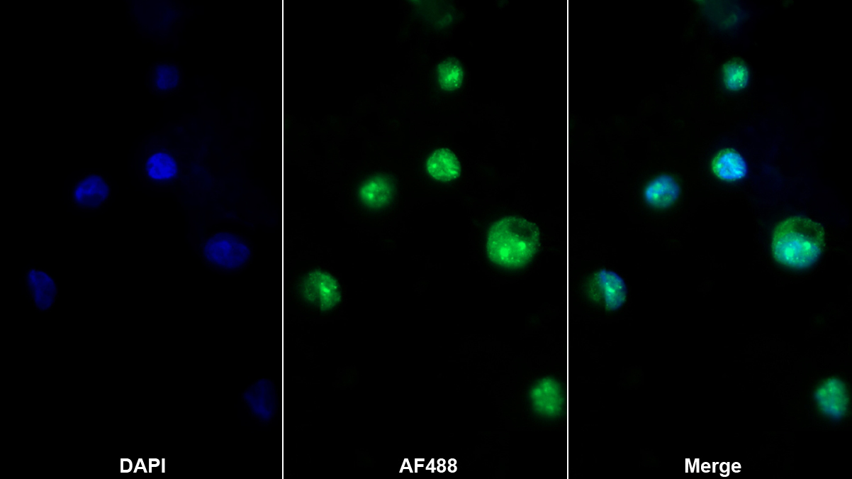 Polyclonal Antibody to Friend Leukemia Virus Integration 1 (FLI1)