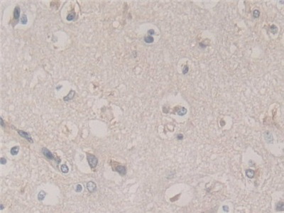 Polyclonal Antibody to Frataxin (FXN)