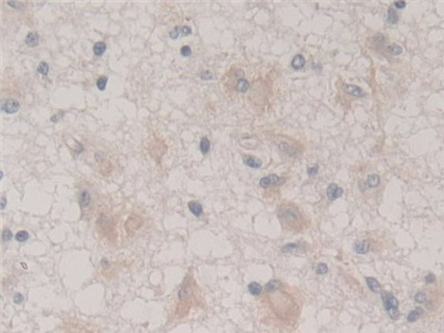 Polyclonal Antibody to Frataxin (FXN)