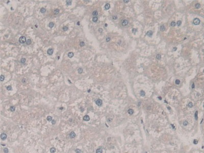 Polyclonal Antibody to Frataxin (FXN)