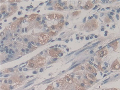 Polyclonal Antibody to Frataxin (FXN)