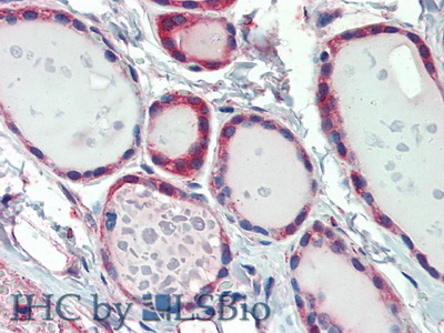 Polyclonal Antibody to Furin (FUR)