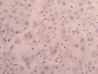 Polyclonal Antibody to Furin (FUR)