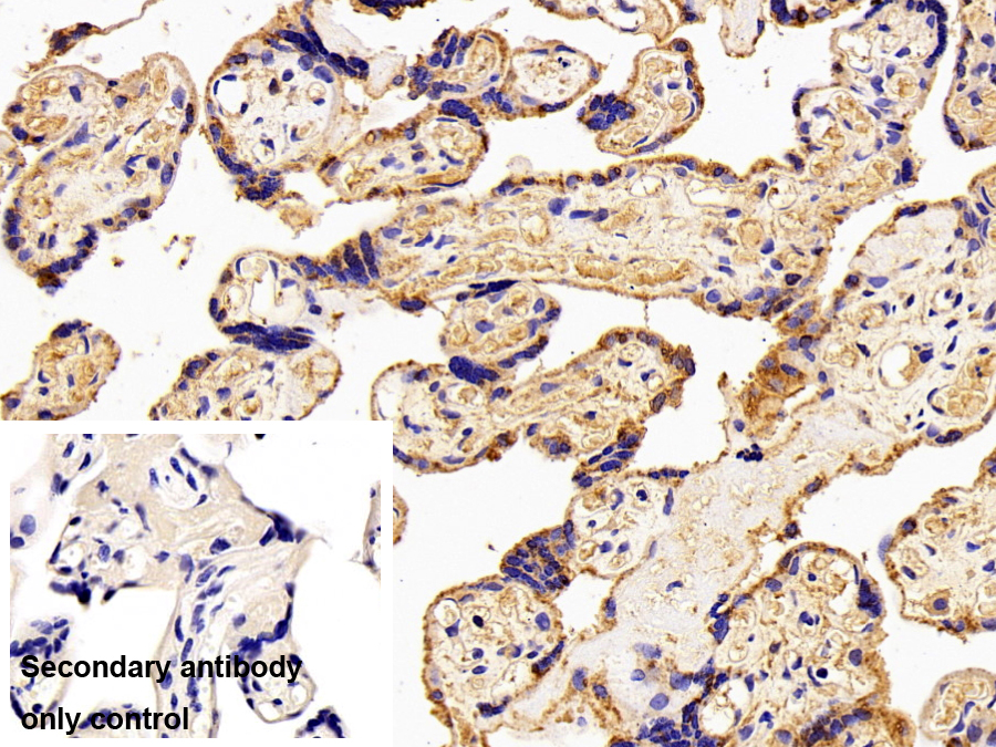 Polyclonal Antibody to Furin (FUR)